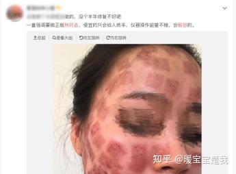 从网红爆款到闭店传言,射频美容仪监管趋严下,初普如何掉队中国市场?