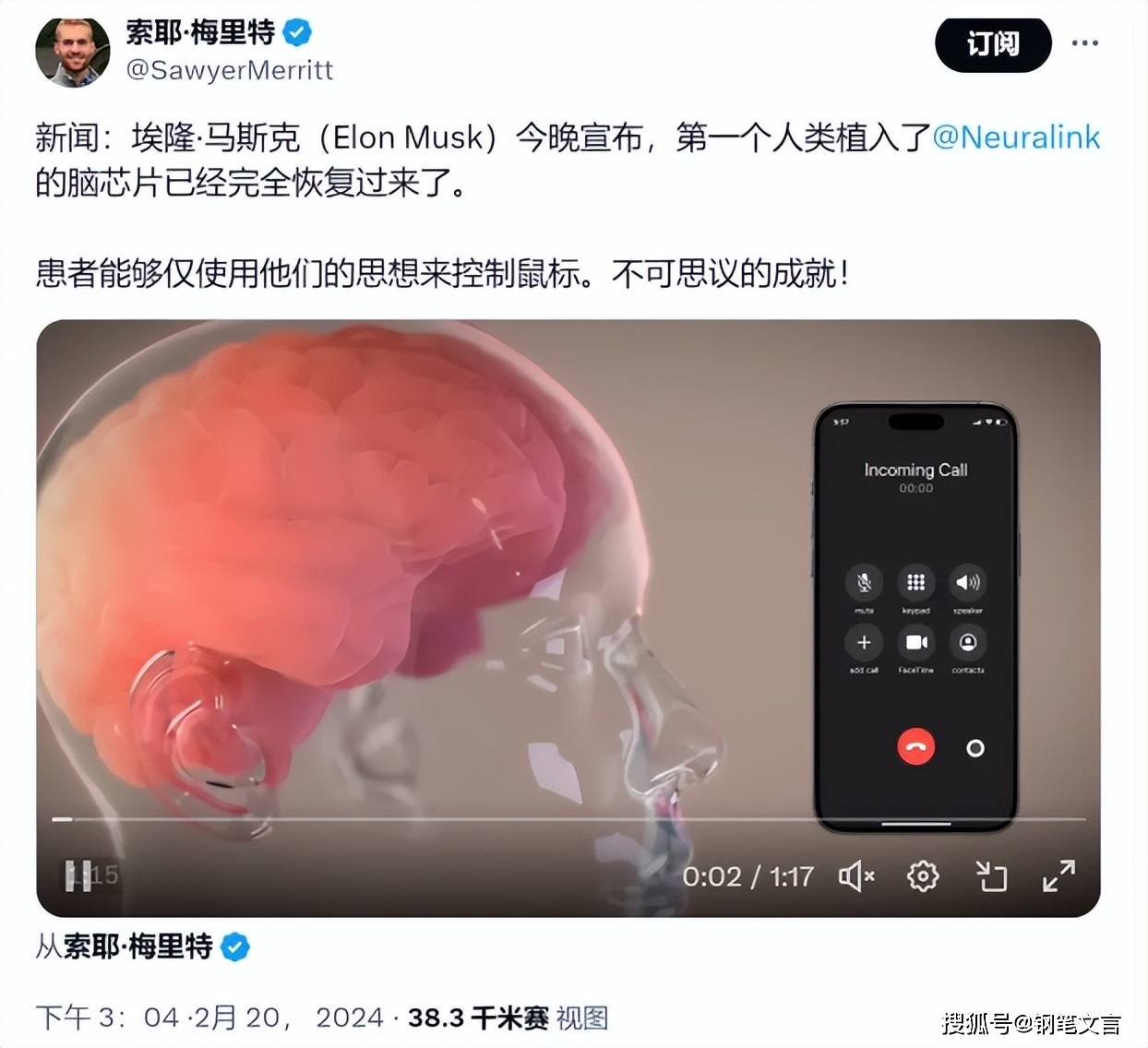 又一家脑机接口公司，备战IPO！红杉、百度加持